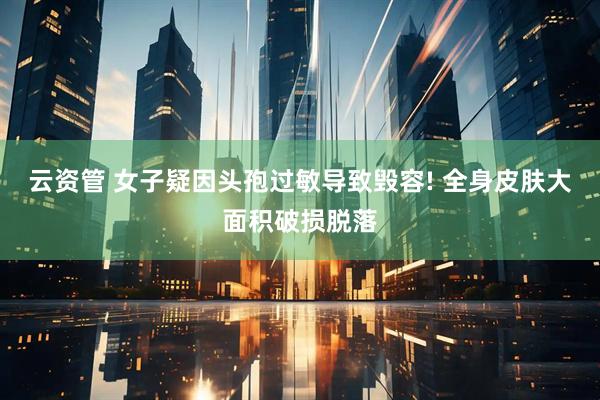 云资管 女子疑因头孢过敏导致毁容! 全身皮肤大面积破损脱落